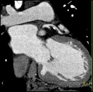 IV contrast image <td align=