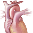 64 Slice MDCT of the Heart