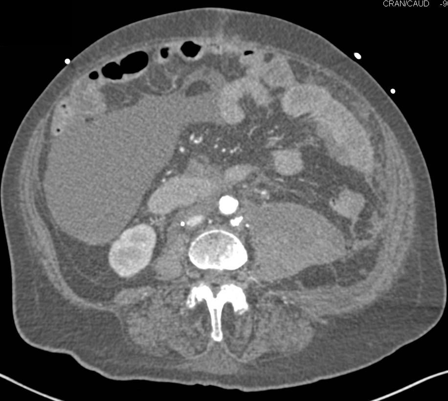 Muscle Spasm Upper Left Quadrant 37