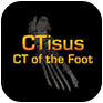 CTisus: CT of the Foot