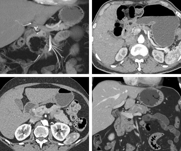 CT Quick Guides - CTisus.com CT Scanning