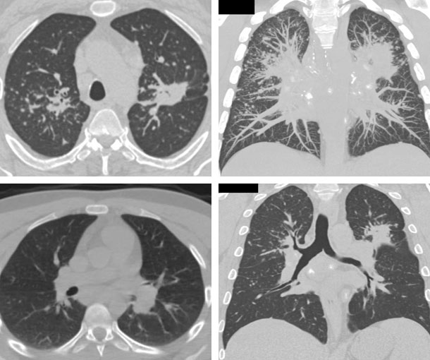 CT Quick Guides - CTisus.com CT Scanning