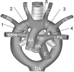 Simplified Late Stage Aortic Arch Development