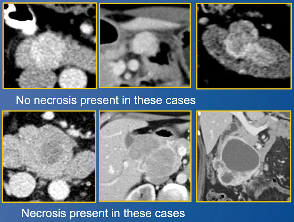 ImagingAdditional Cases - Duodenum