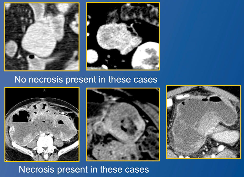 ImagingAdditional Cases - Jejunum