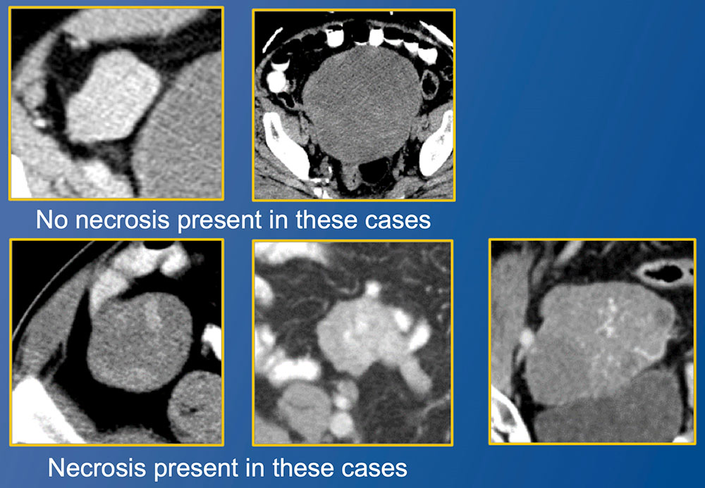 Imaging:Additional Cases - Ileum