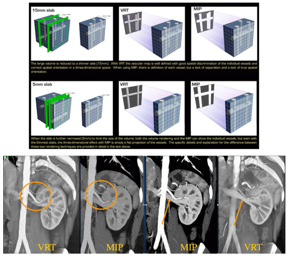 3D Imaging in Radiology: What A Long Strange Trip It's Been