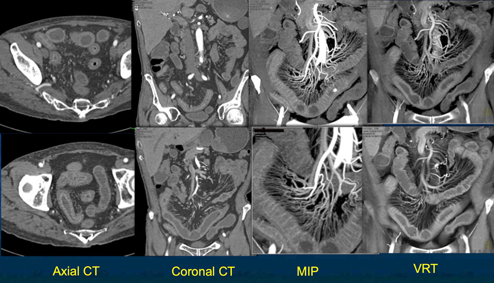 3D Imaging in Radiology: What A Long Strange Trip It's Been