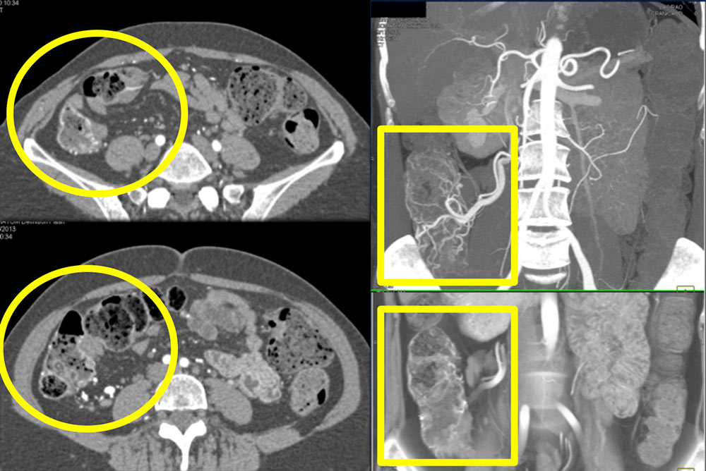 3D Imaging in Radiology: What A Long Strange Trip It's Been