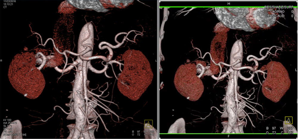 3D Imaging in Radiology: What A Long Strange Trip It's Been