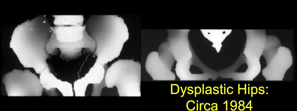 3D Imaging in Radiology: What A Long Strange Trip It's Been