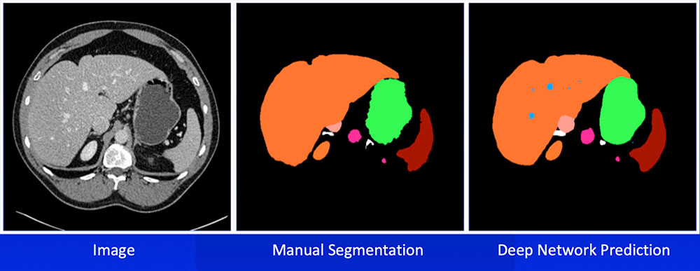 Multi-Organ Segmentation
