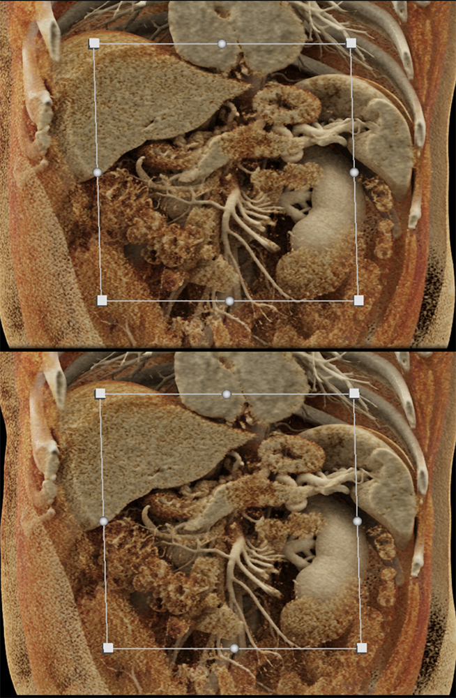 Texture Changes in the Gland
