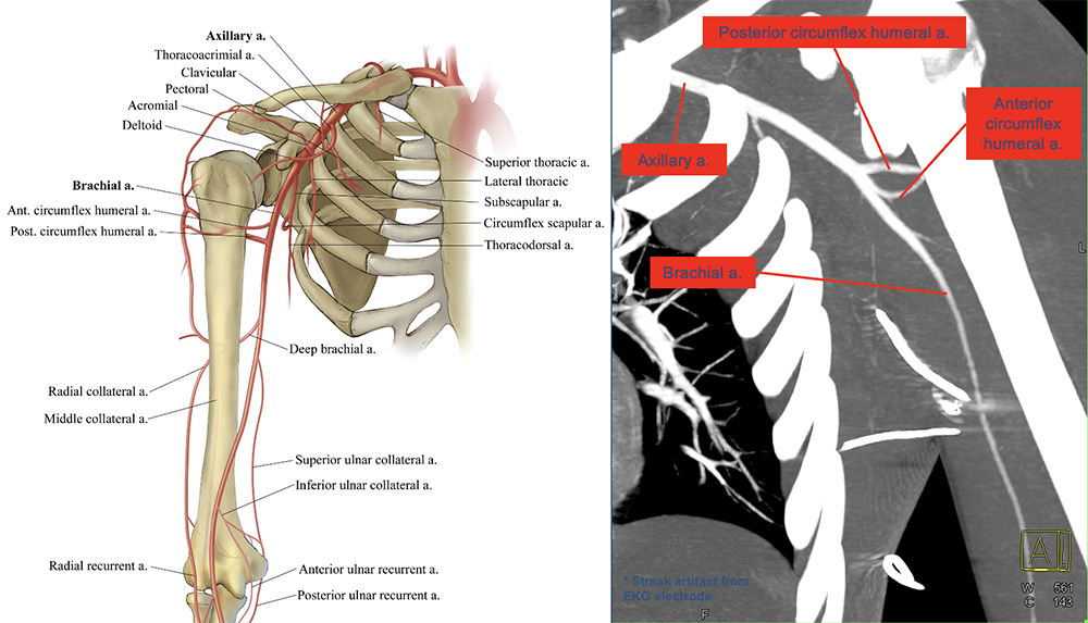 Pertinent vascular MDCT angiography anatomy