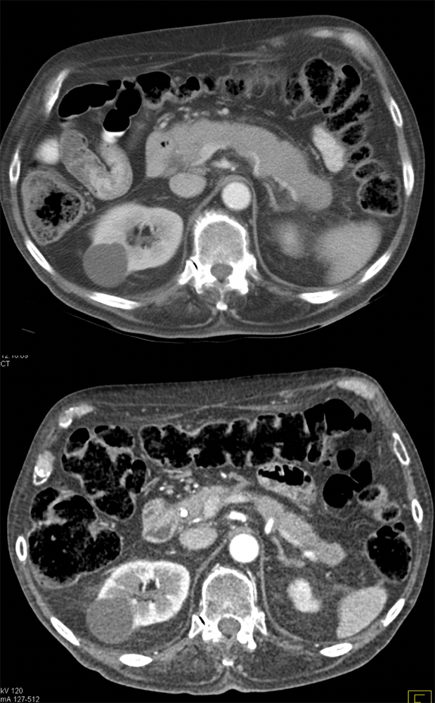 Pre and Post Treatment