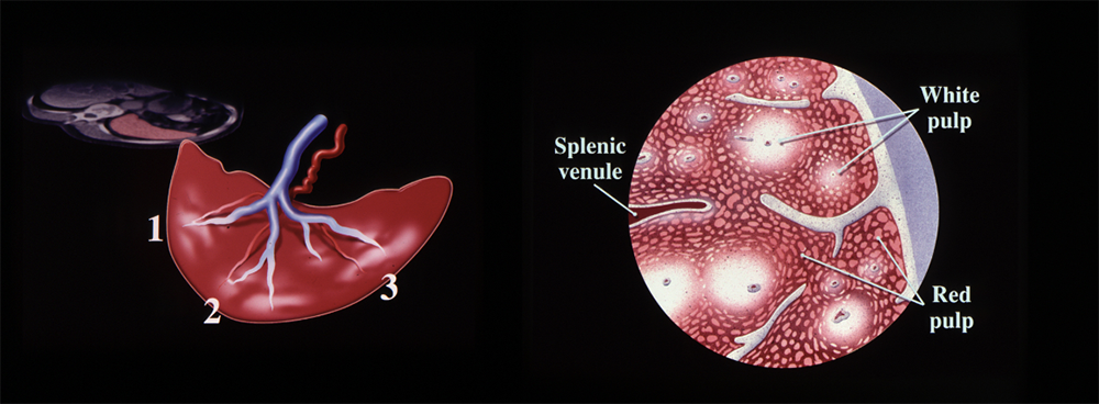 CT of the Spleen