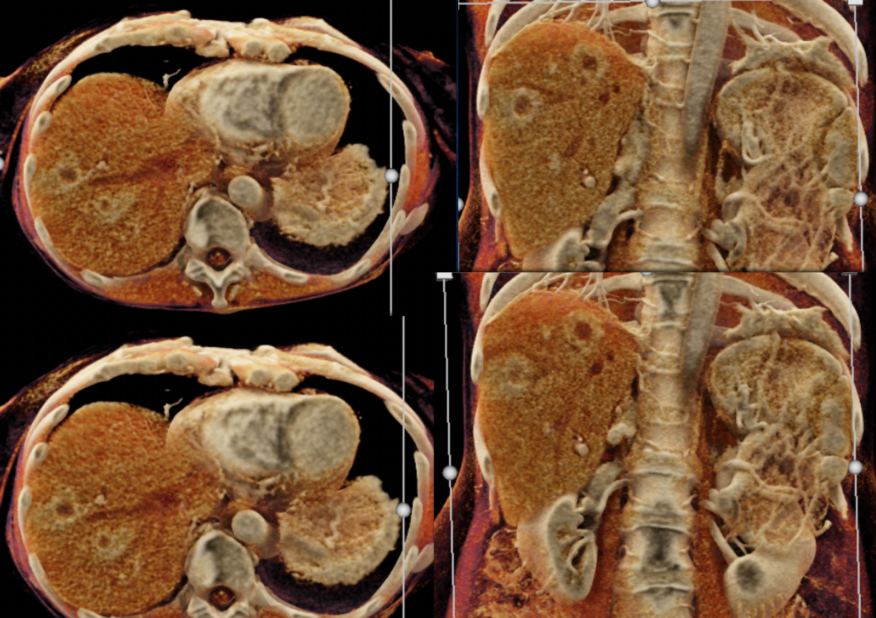 Perfusion changes