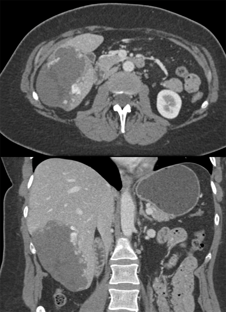 Gastrointestinal - Learning Modules - CTisus.com CT Scanning