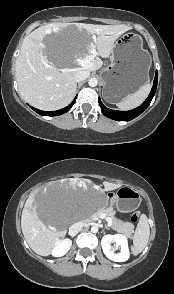 Gastrointestinal - Learning Modules - CTisus.com CT Scanning