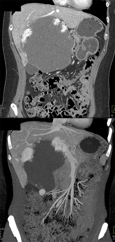 Gastrointestinal - Learning Modules - CTisus.com CT Scanning