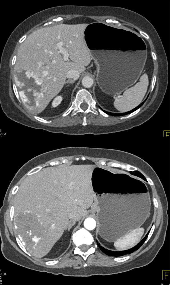 Gastrointestinal - Learning Modules - CTisus.com CT Scanning