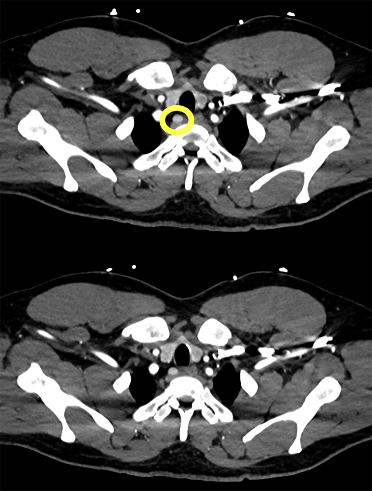 Diagnosis Please