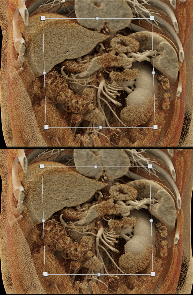 Texture Changes in the Gland