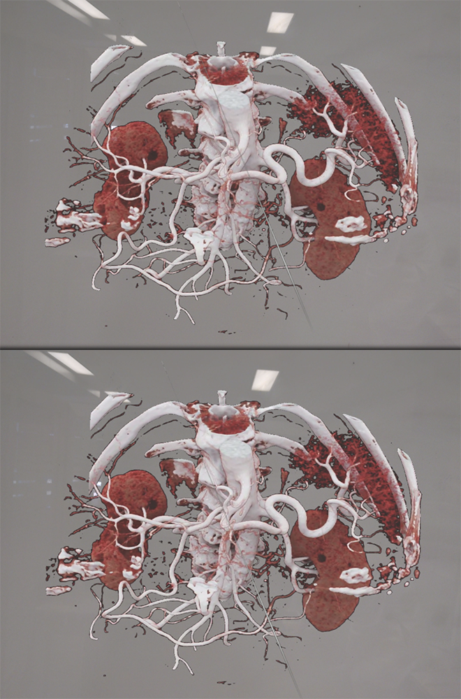 Pancreatic Cancer Imaging