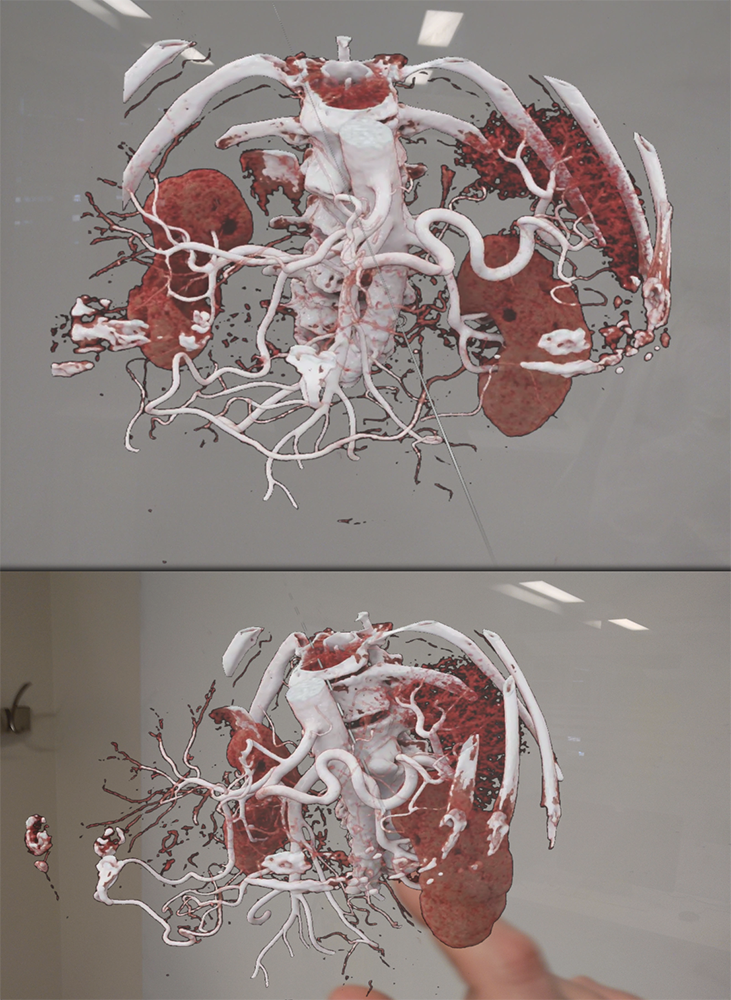 Pancreatic Cancer Imaging