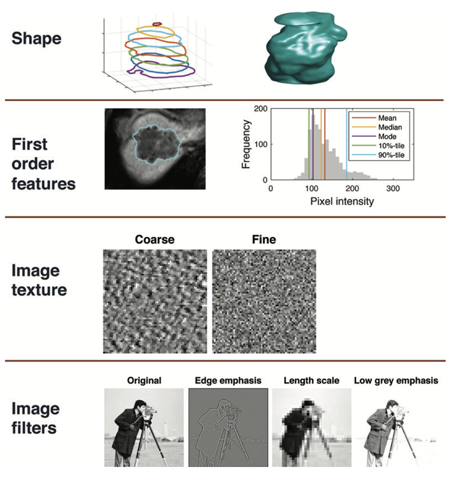 Pancreatic Cancer Imaging