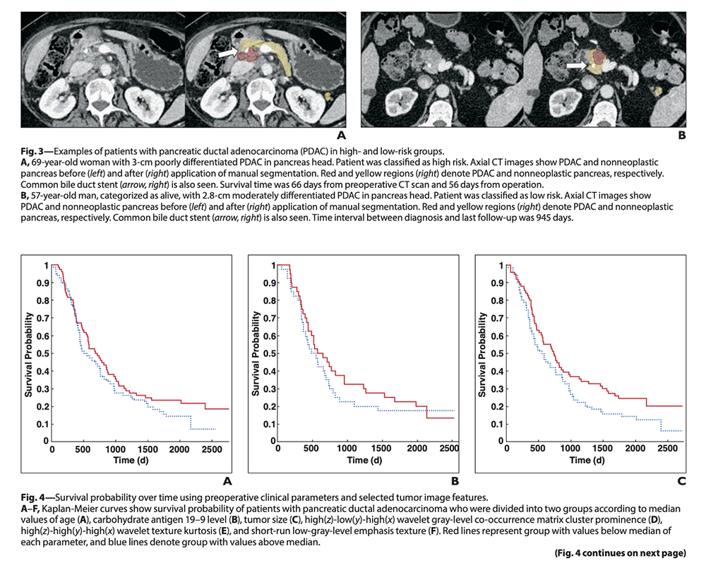 Pancreatic Cancer Imaging