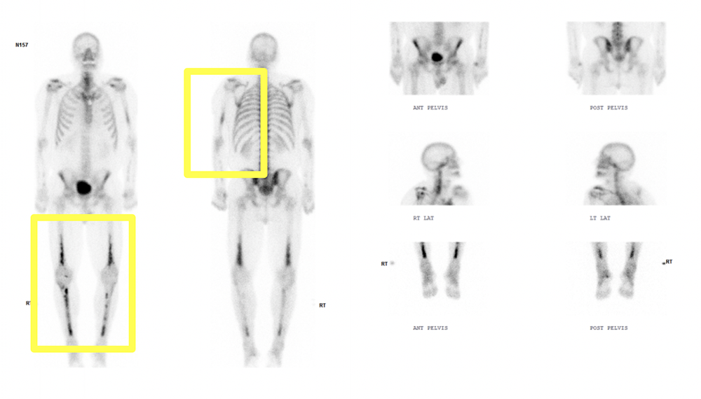 CT of the Perirenal Space