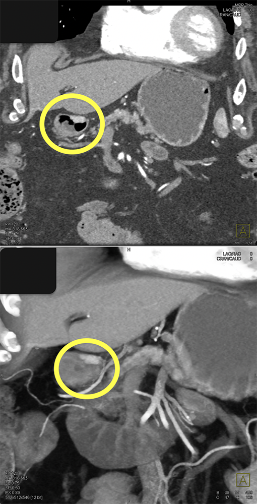 Coronal and VRT Views