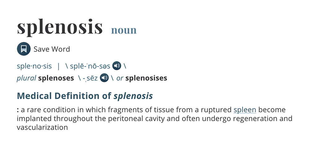 CT of Splenic Anomalies