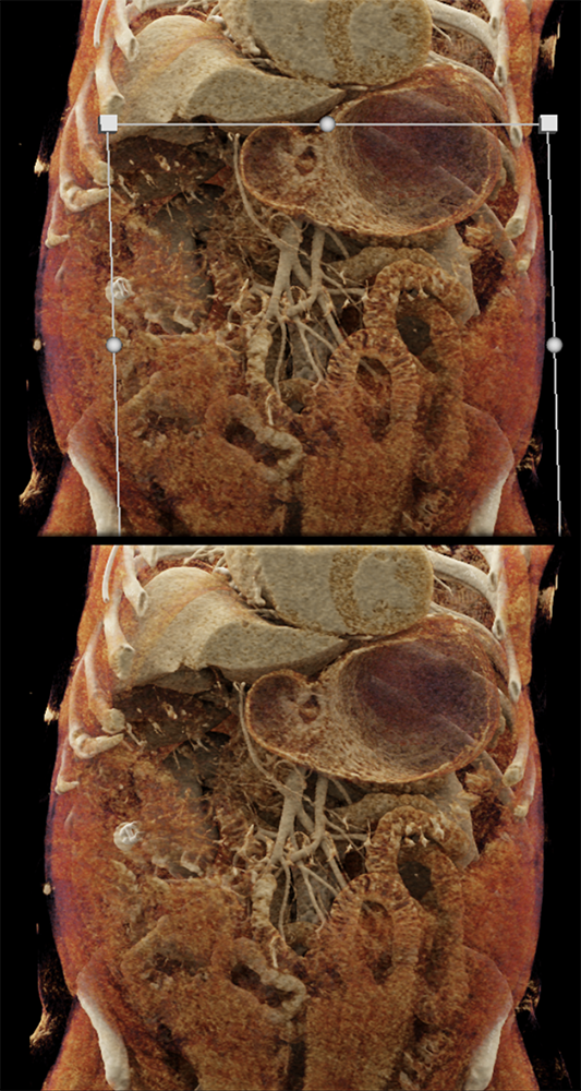 CT of the Stomach