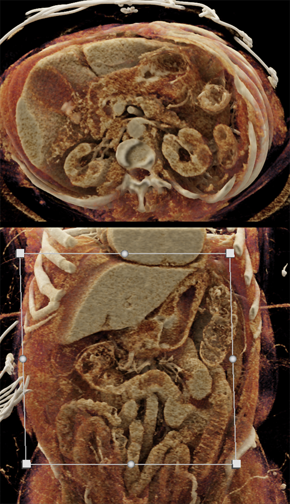 CT of the Stomach