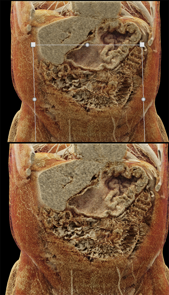 CT of the Stomach