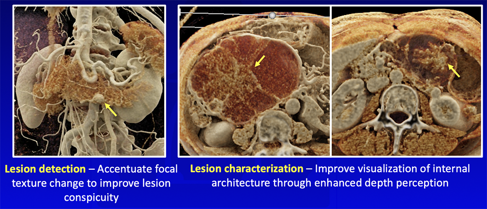 Oncologic – Lesion Detection and Characterization