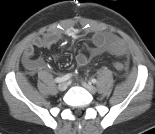 Syllabus - CTisus.com CT Scanning