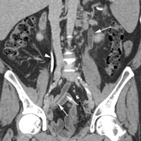   Fig. 7C 