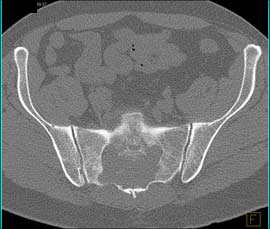 Musculoskeletal Anatomical Region Quiz - Educational Tools | CT ...