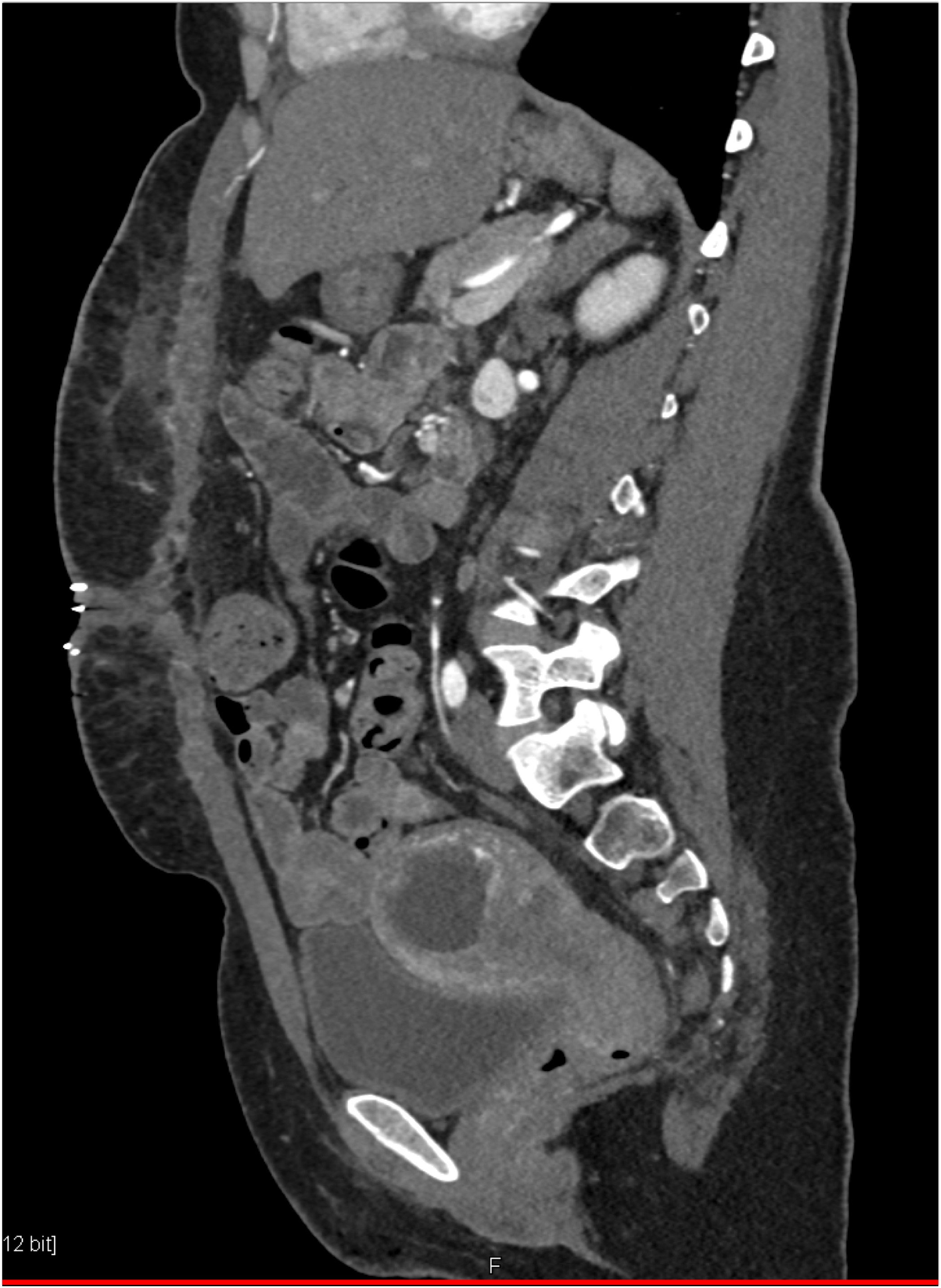 Quiz Of The Month June 2023 Learning Modules CT Scanning CT 