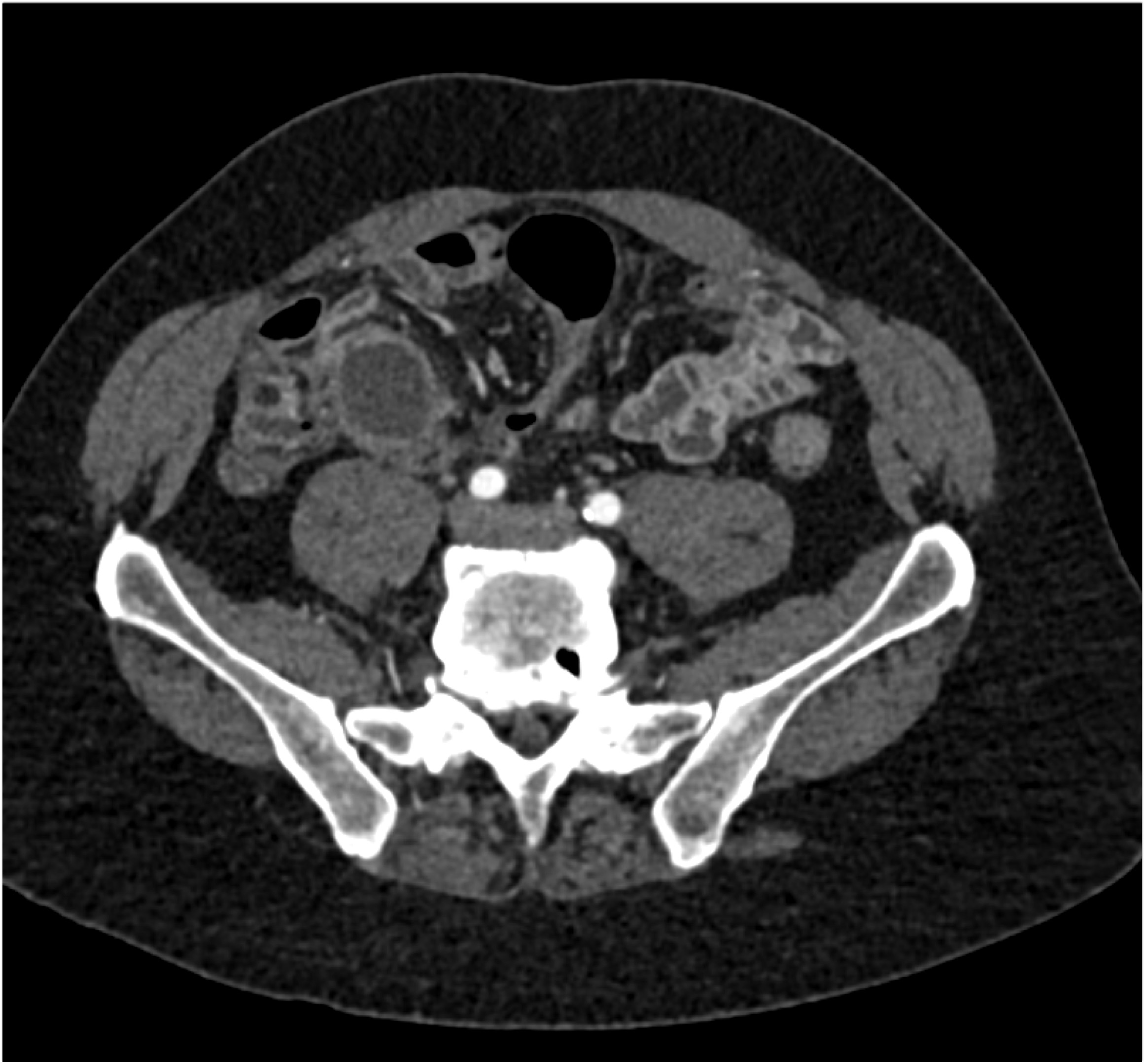 CTisus Quiz