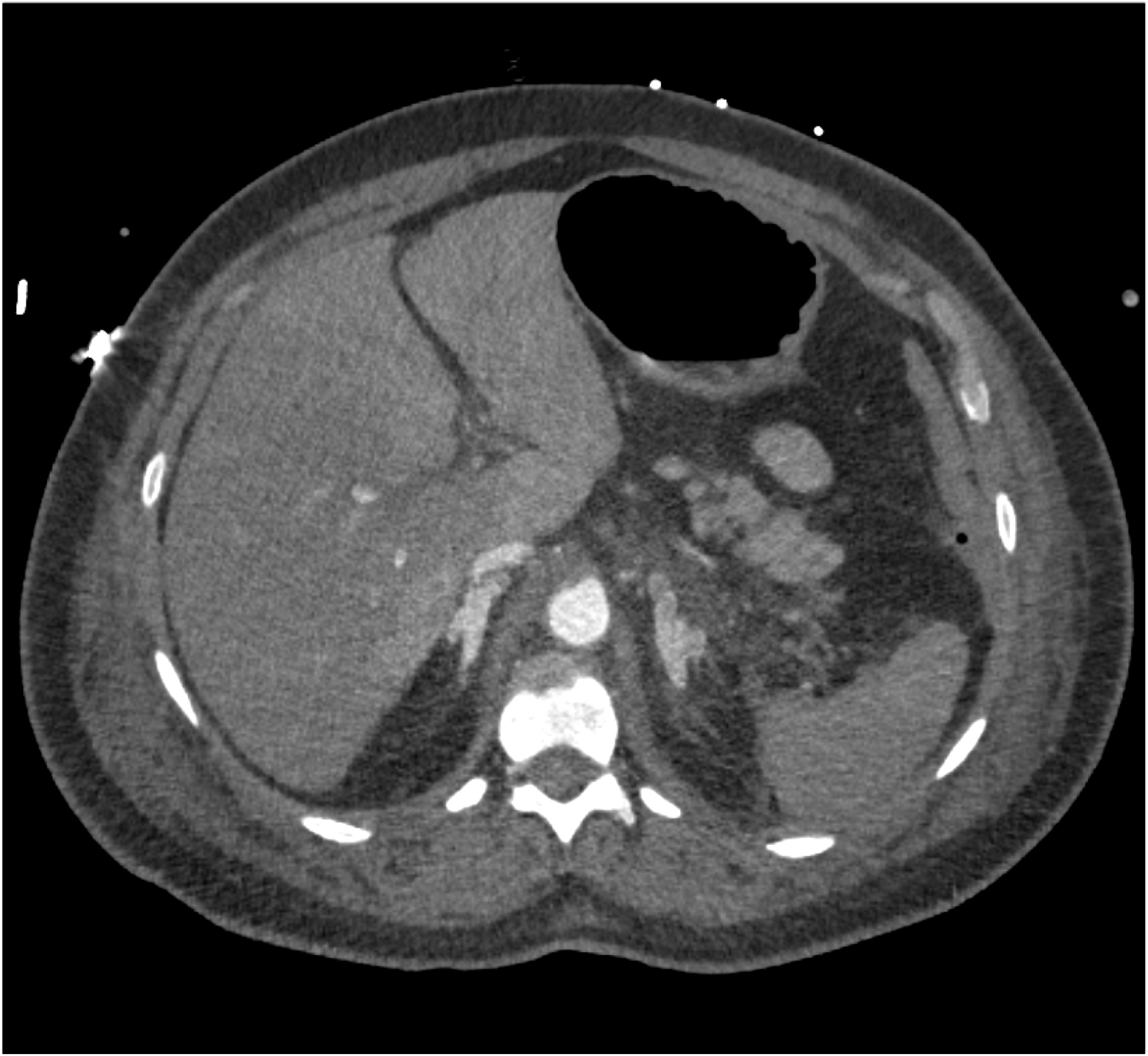CTisus Quiz