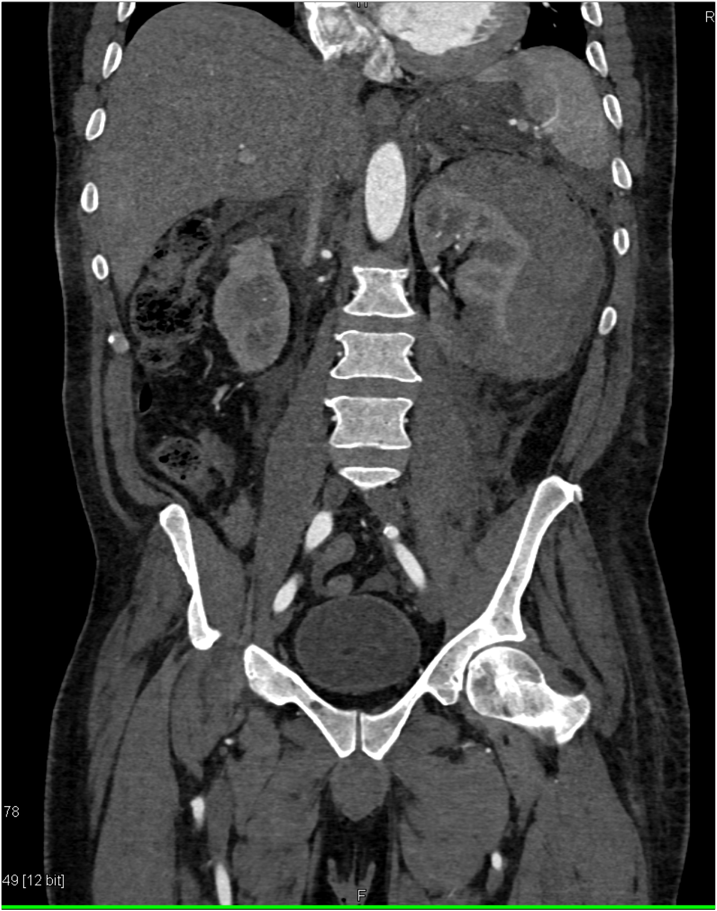 CTisus Quiz