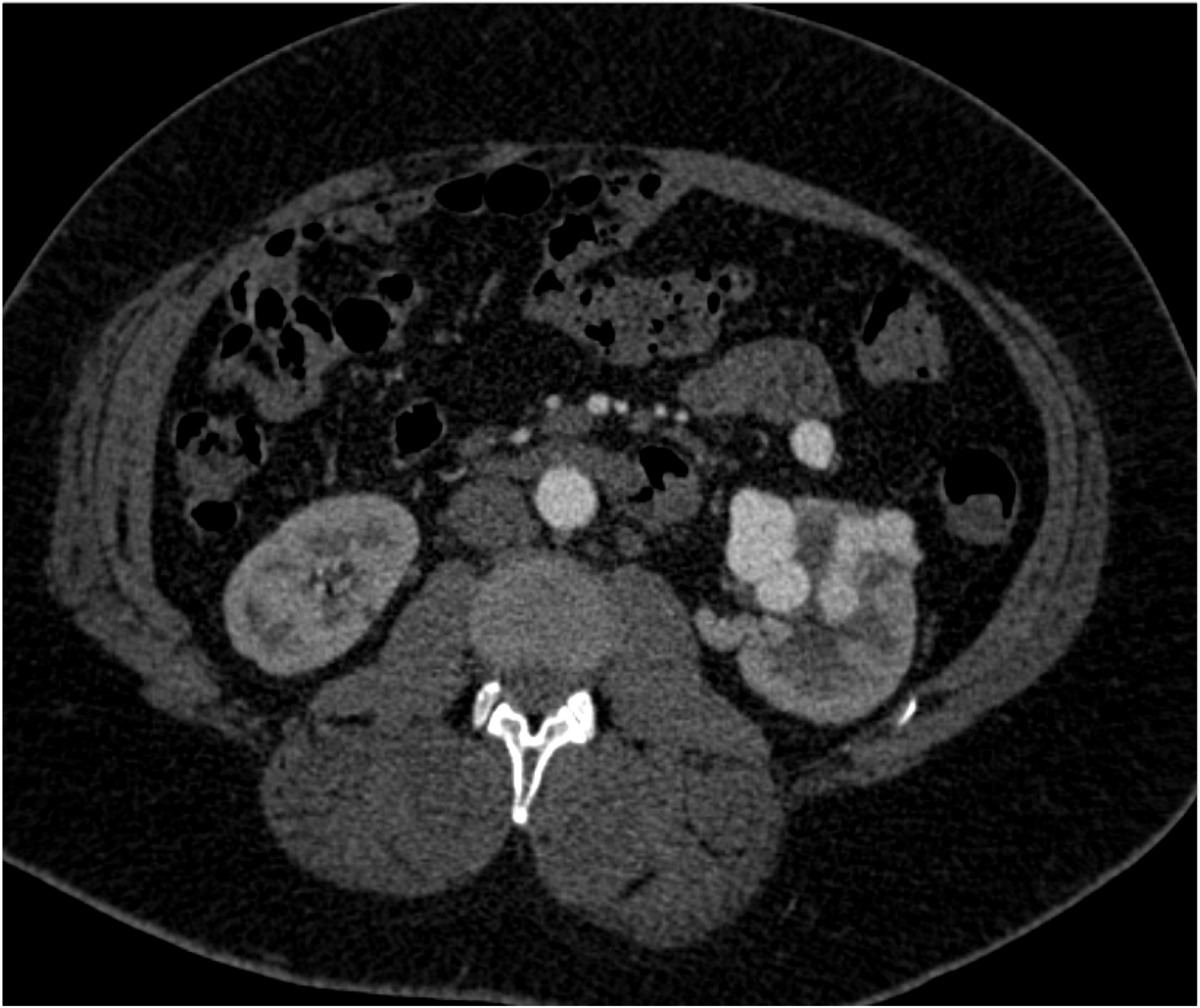 CTisus Quiz