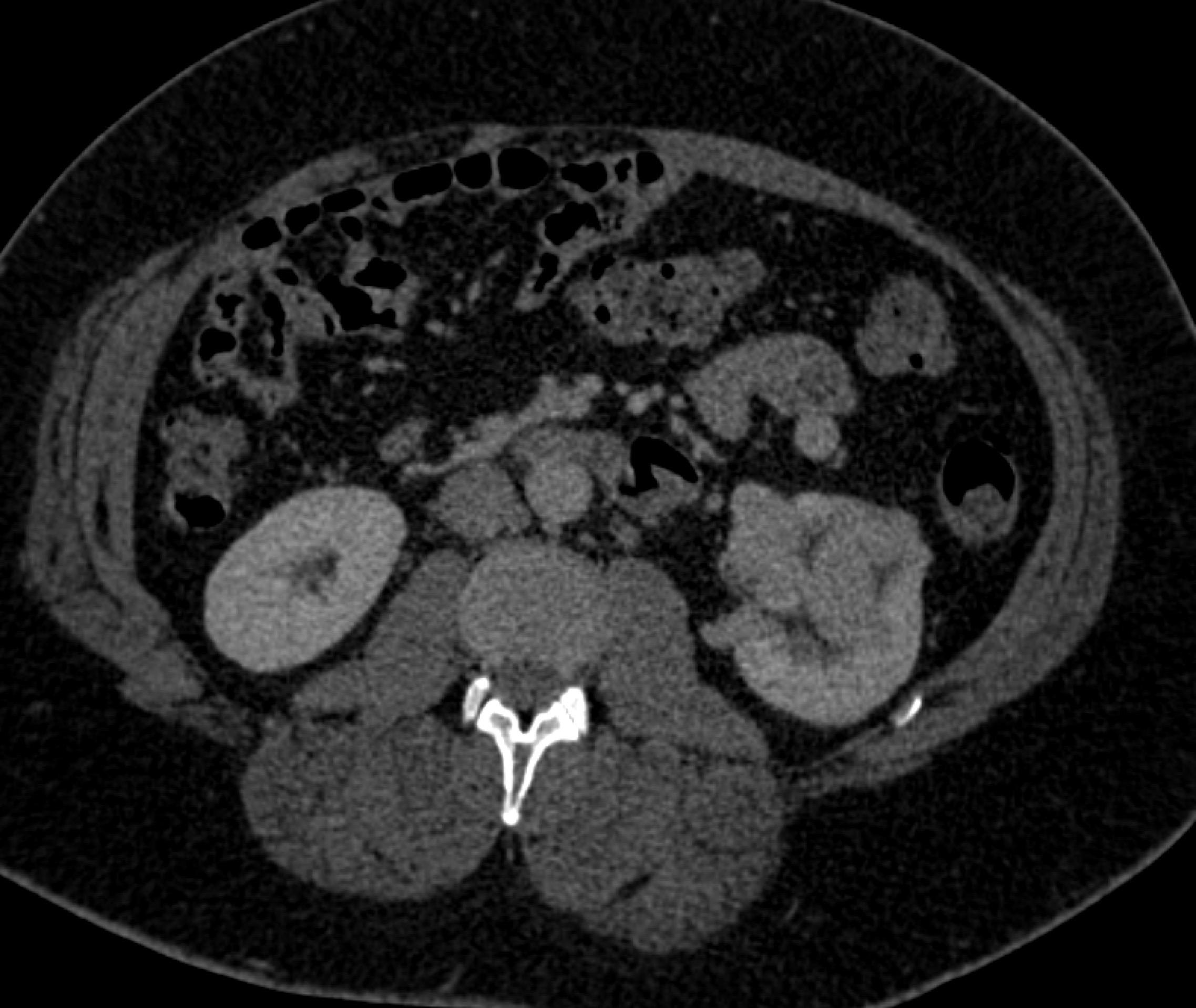 CTisus Quiz