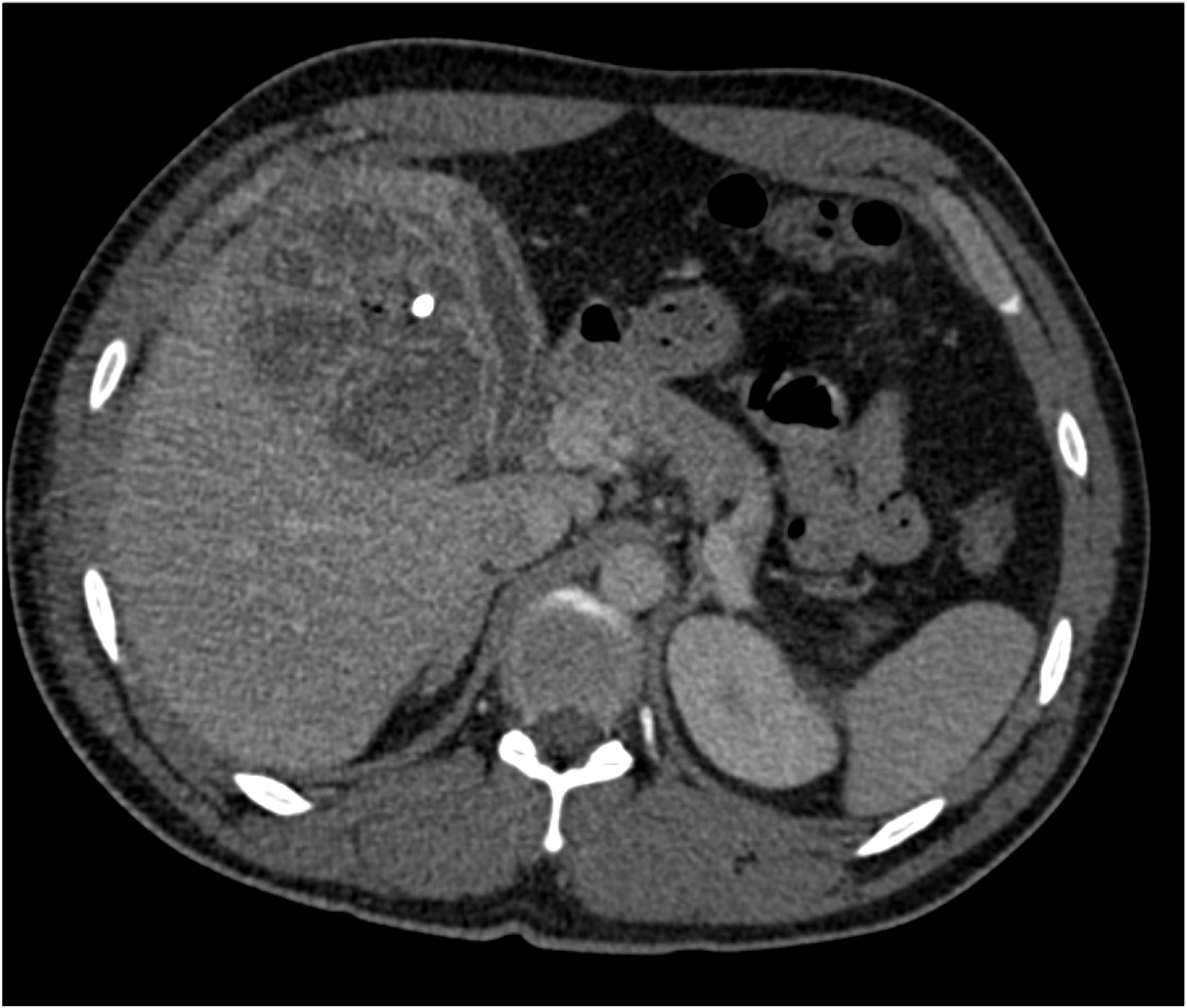 CTisus Quiz