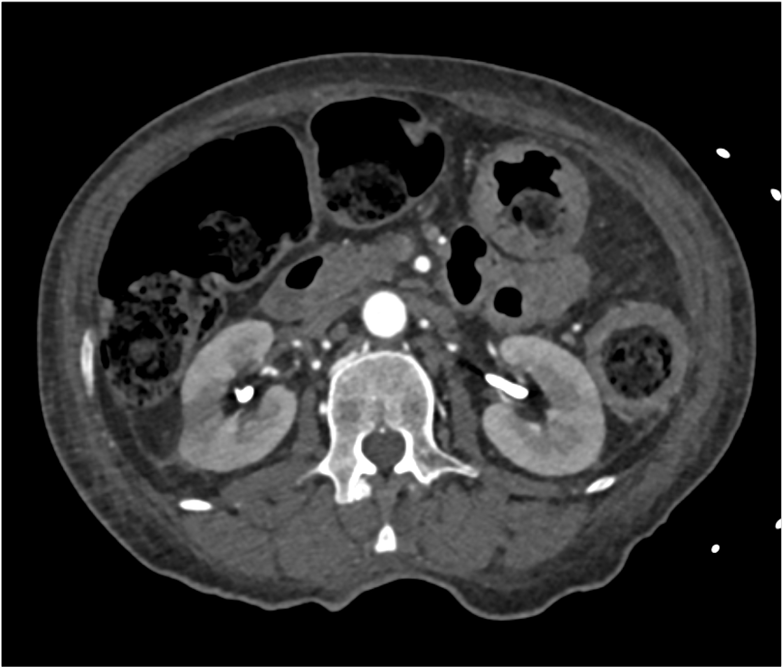 CTisus Quiz