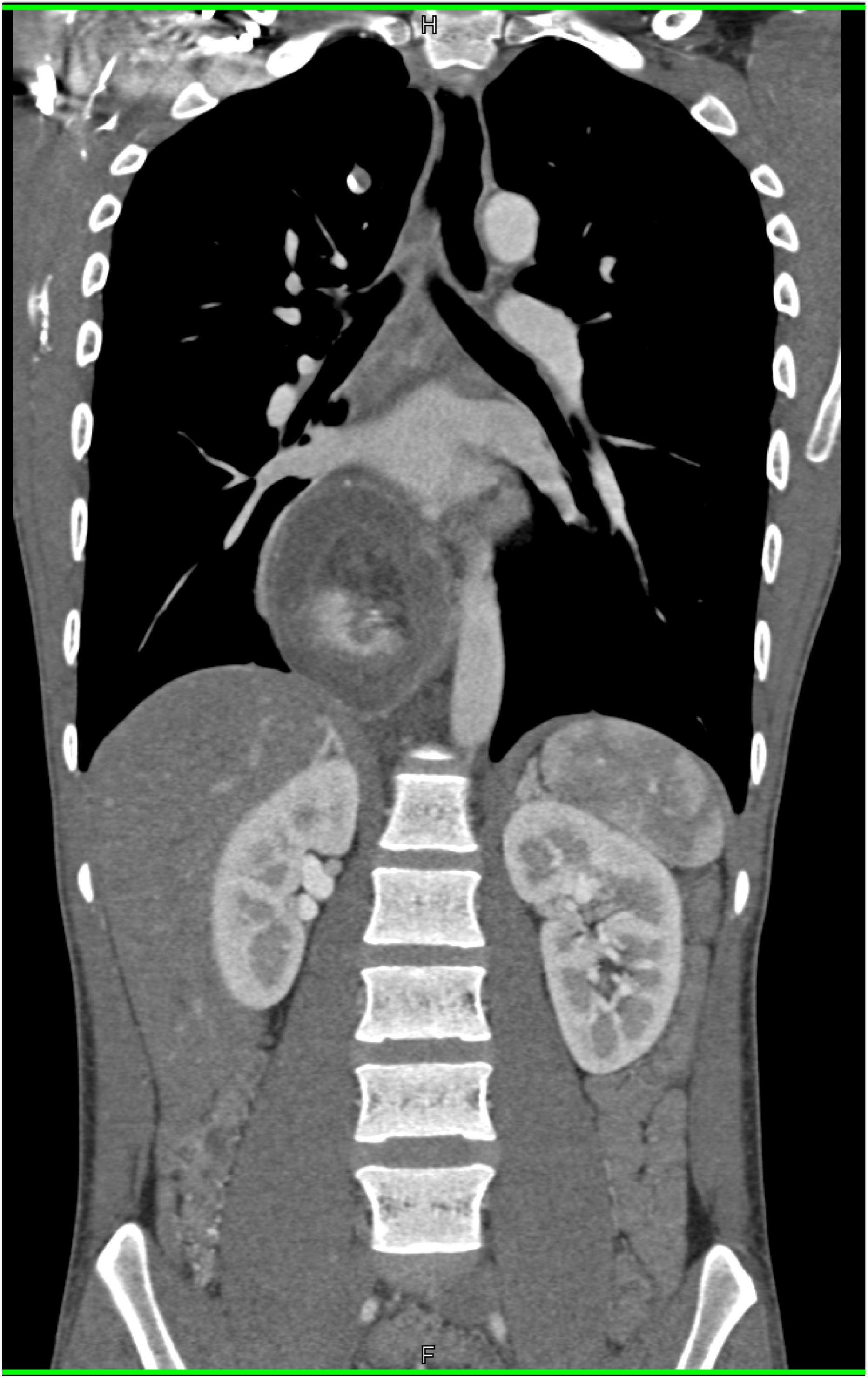 CTisus Quiz